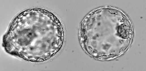 LICAMM - Embryology