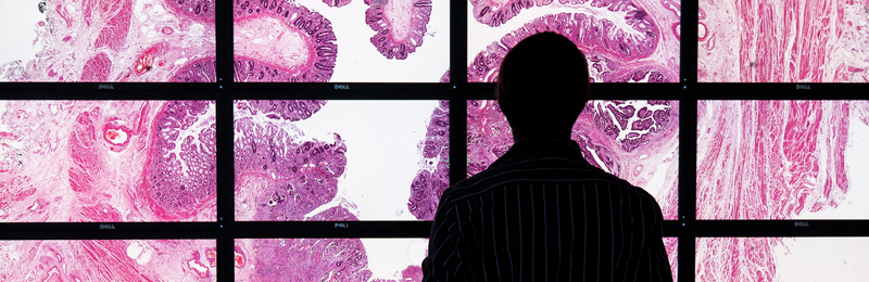 The silhouette of a man standing in front of a large screen. On the screen is an image of a tumour in pink and white.
