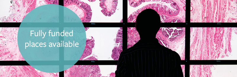 The silhouette of a man standing in front of a large screen. On the screen is an image of a tumour in pink and white.