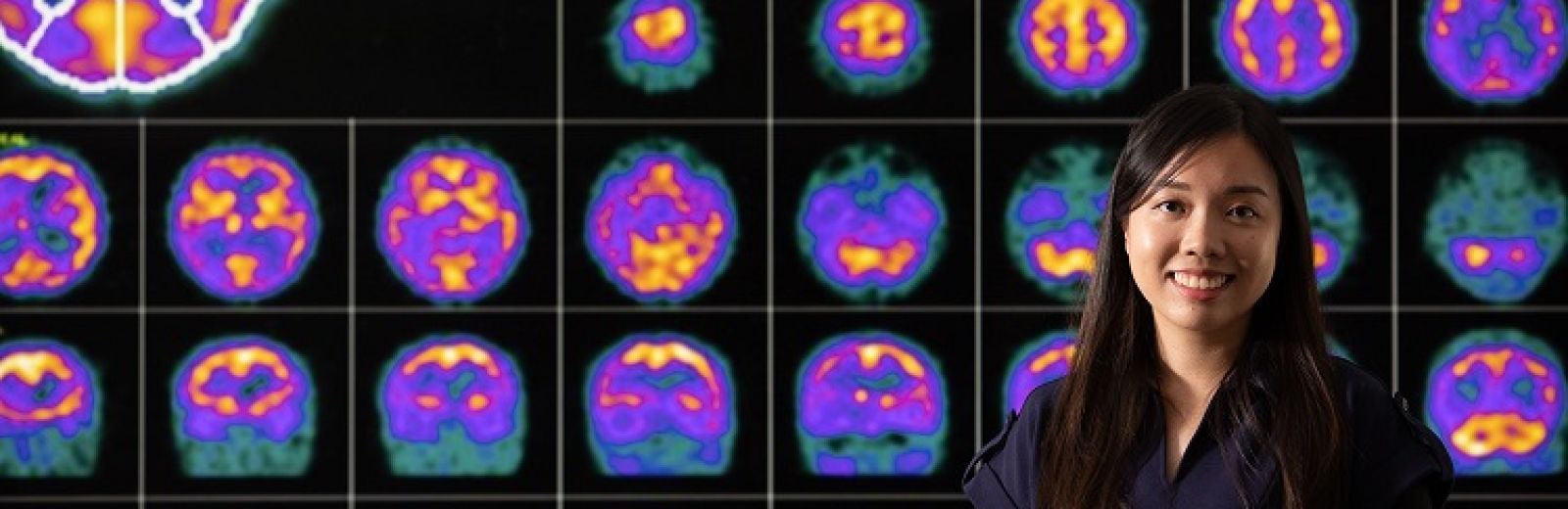 The university of leeds master course in medical imaging offers a broad range of core and optional modules covering the theory and physics of imaging